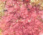 2 – Tallo epifita su una corallinacea crostosa